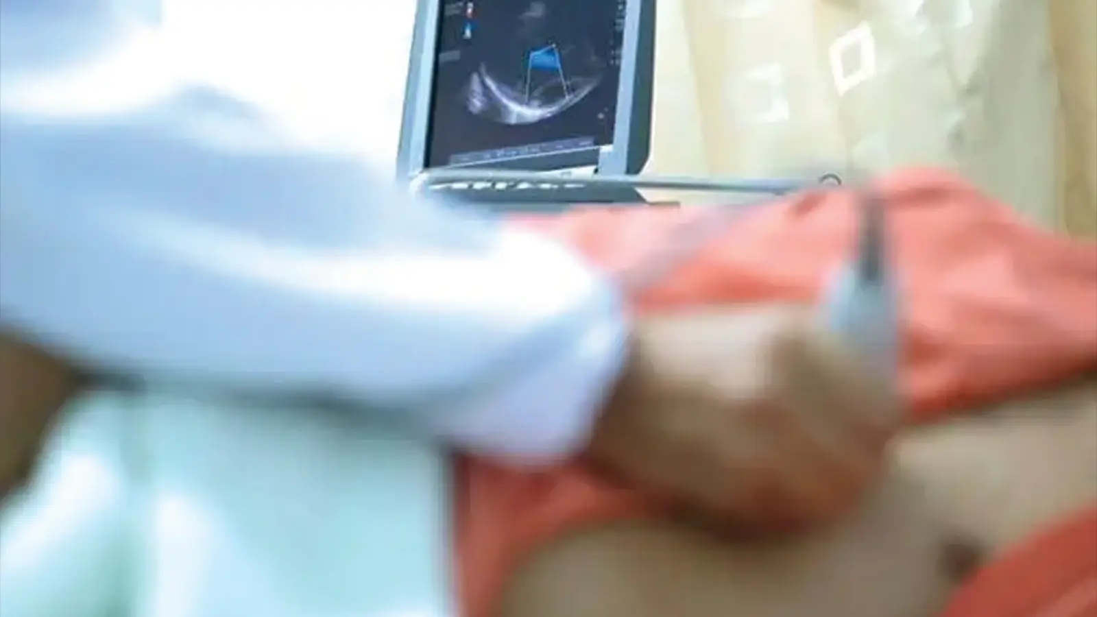 Image of ECHOCARDIOGRAM