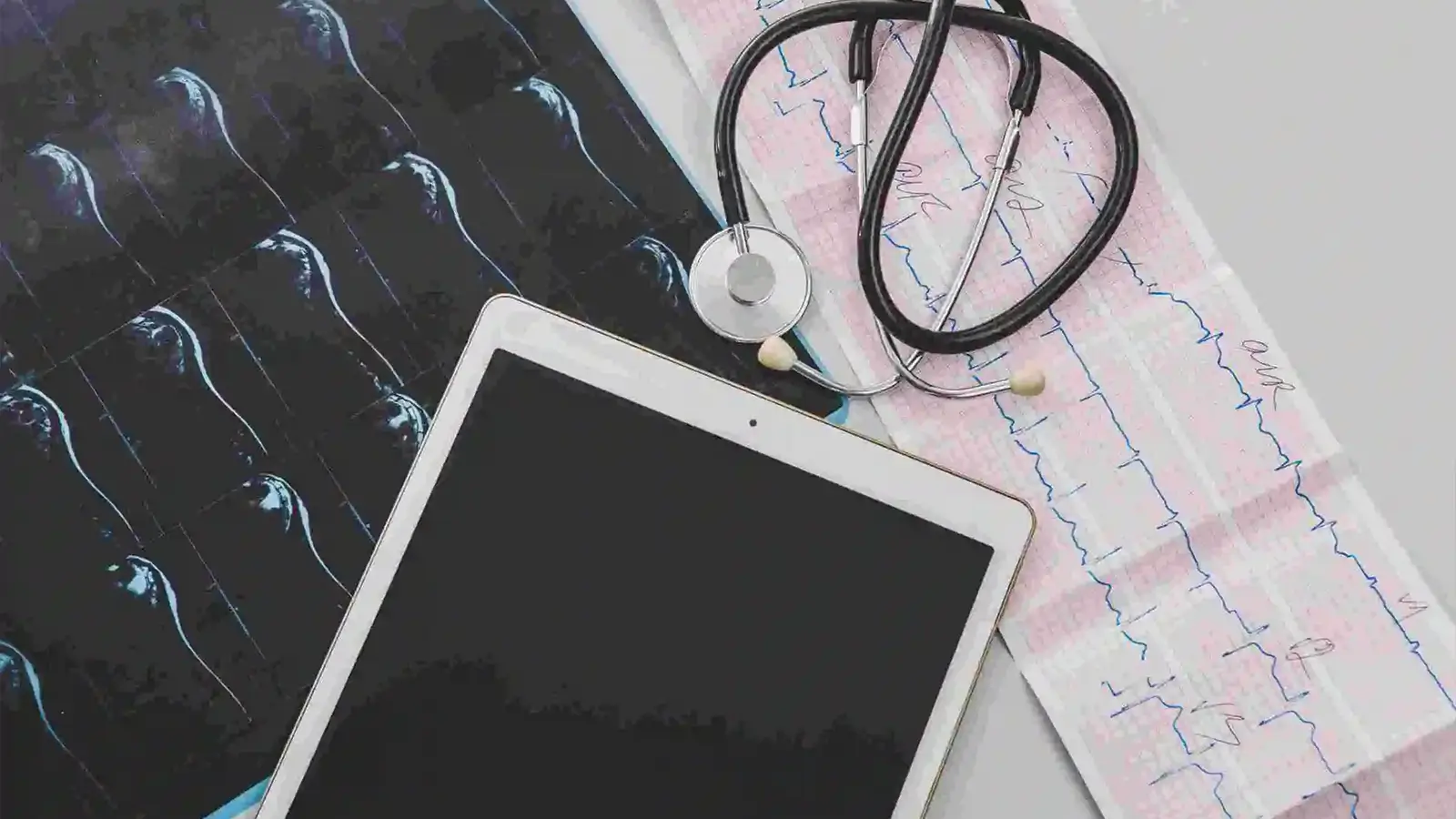 Image of ELECTROCARDIOGRAM ECG