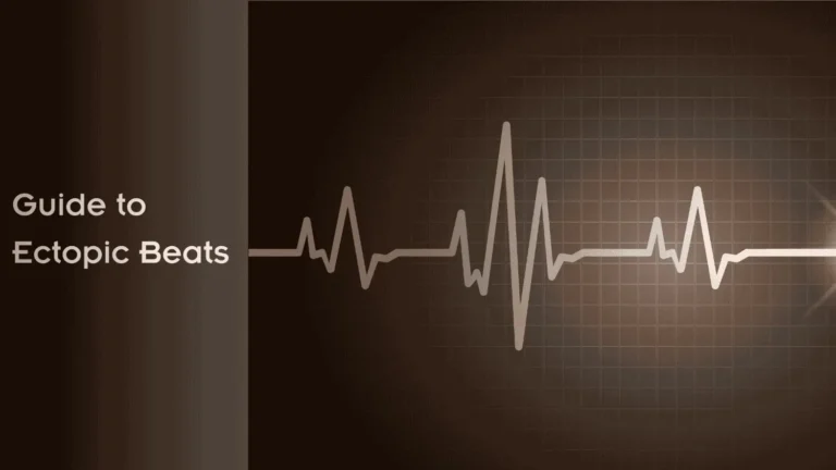 Guide to Ectopic Beats
