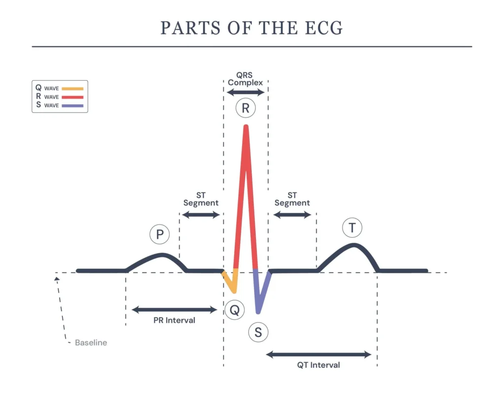 Parts of ECG Waveform