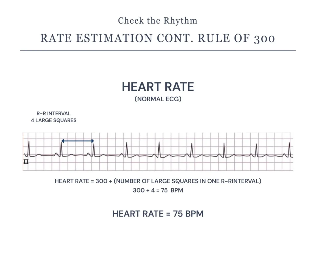 How to Count the Heart Rate in ECG Graph?