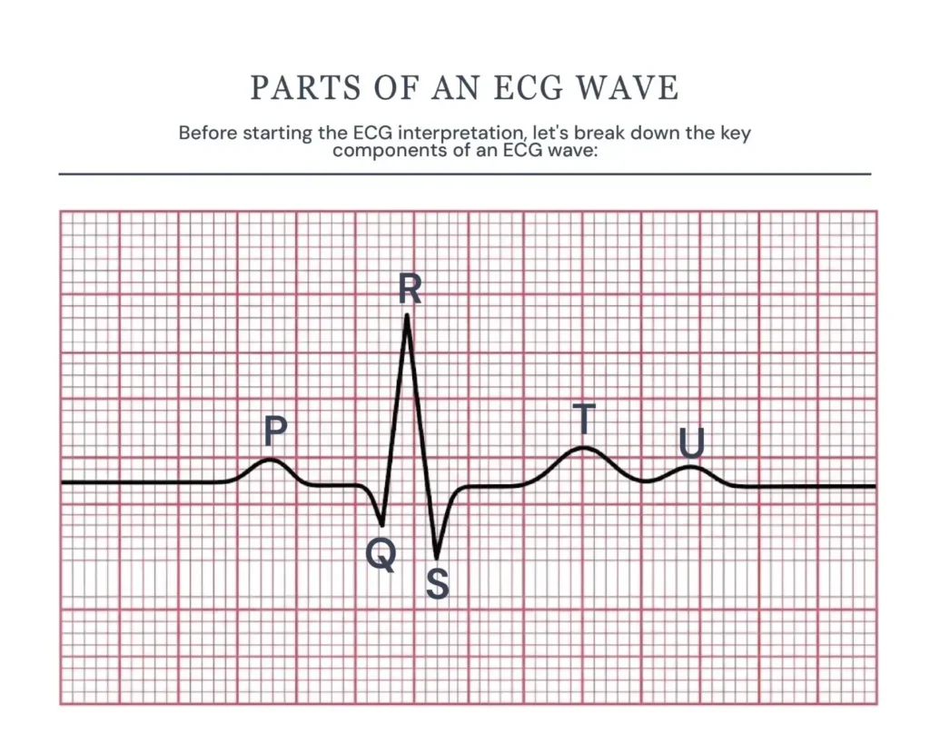 ECG Graph