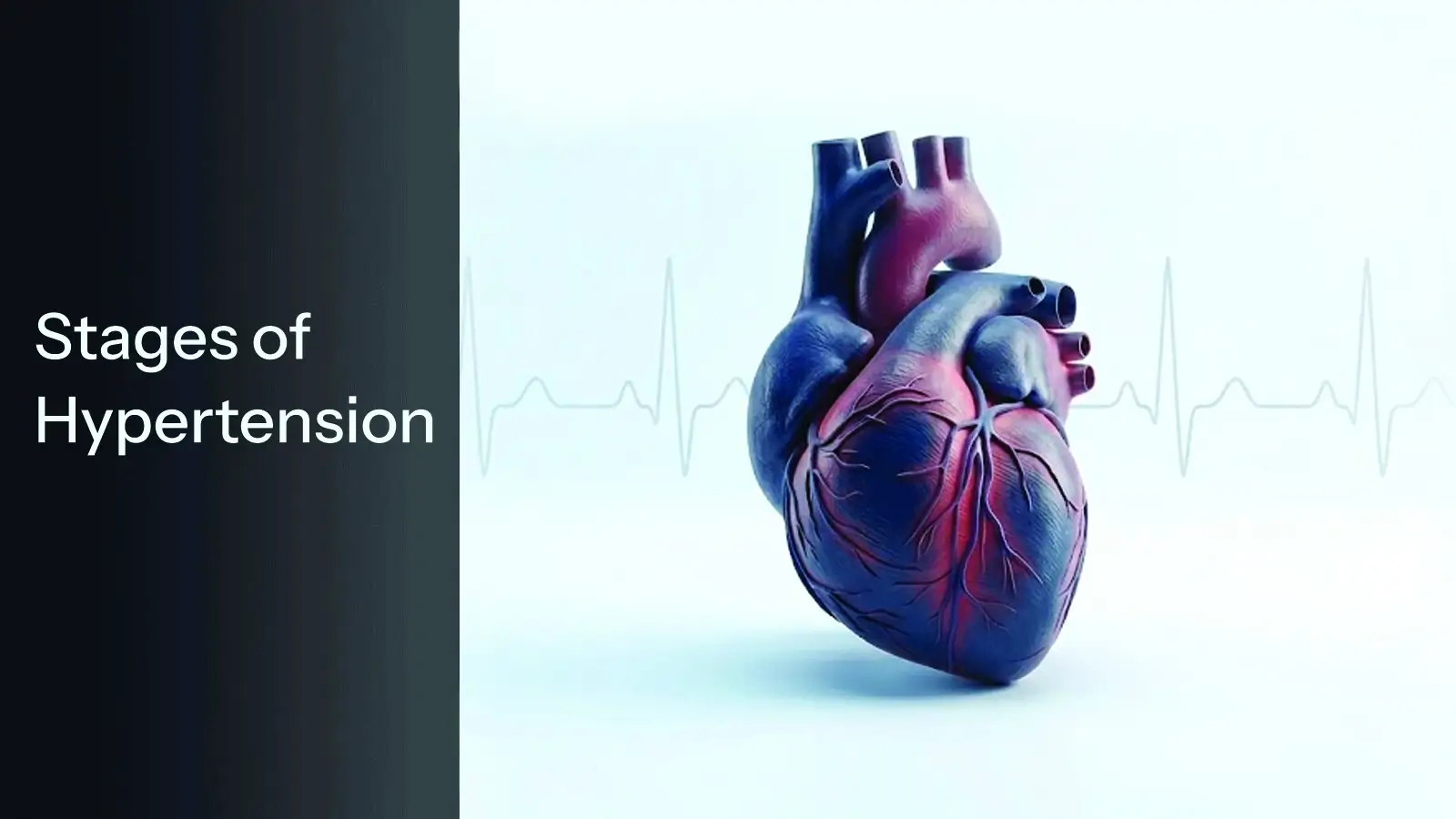 Stages of Hypertension
