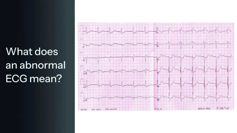 What does an abnormal ECG mean
