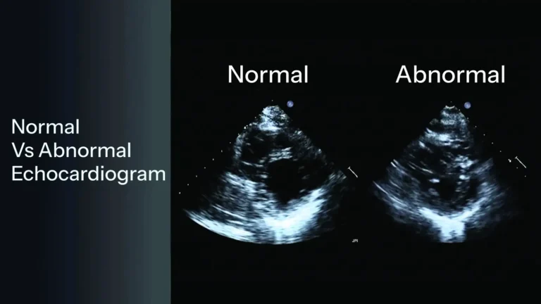 Normal Vs Abnormal Echocardiogram