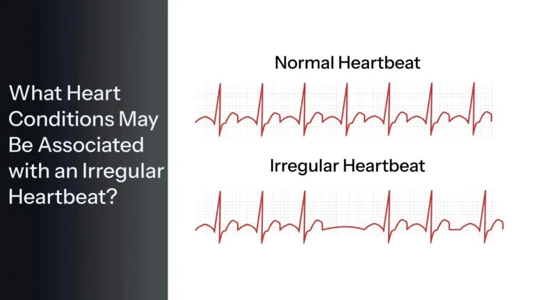 What heart conditions may be associated with irregular heartbeat