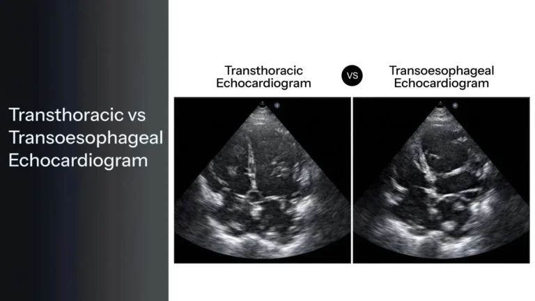 transthoracic vs transoesophageal echocardiogram